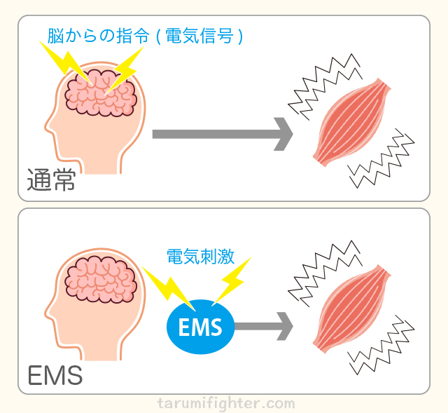EMS