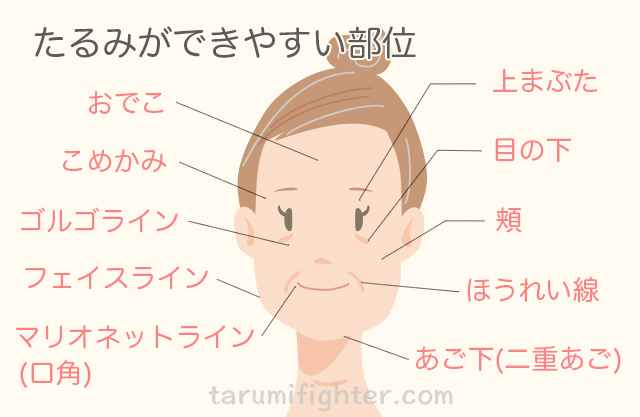 たるみの位置